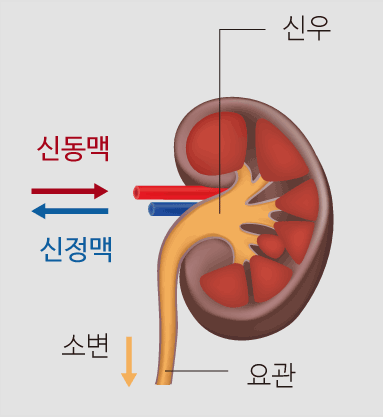 신우신염