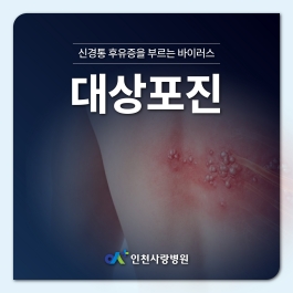 대상포진보다 무서운 대상포진 후 신경통