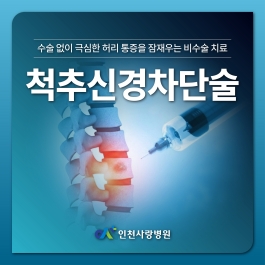극심한 허리 통증 비수술 치료 척추신경차단술