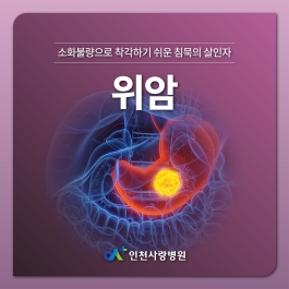 소화불량으로 착각하기 쉬운 위암