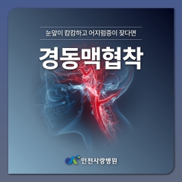 눈앞이 캄캄하고 잦은 어지럼증, 혈관 통로가 막히는 경동맥협착?