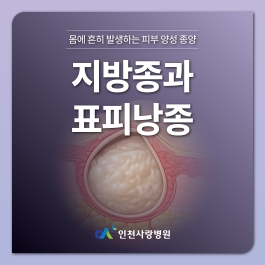 몸에 흔히 발생하는 지방종 · 표피낭종 차이