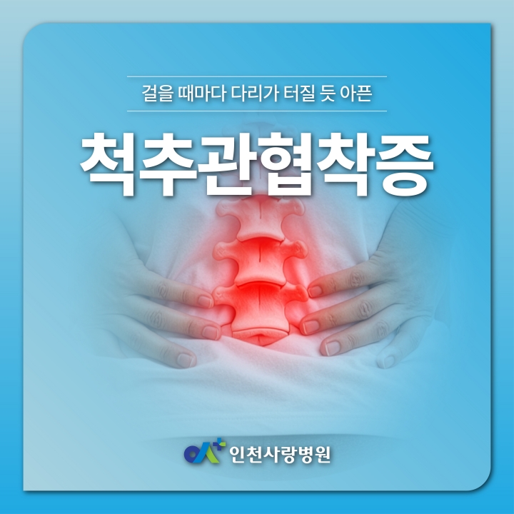 걸을 때마다 다리가 터질 듯 아프다면? 척추관협착증 의심