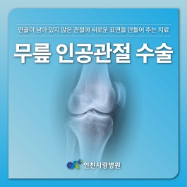계단이 힘든 무릎, 인공관절 수술 고민 된다면